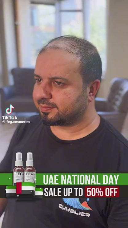 FEG Plus Hair Growth Spray (Original)